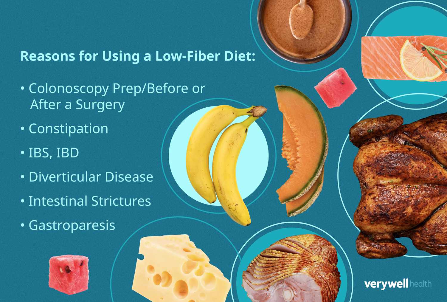 Low-fiber diet do's and don'ts